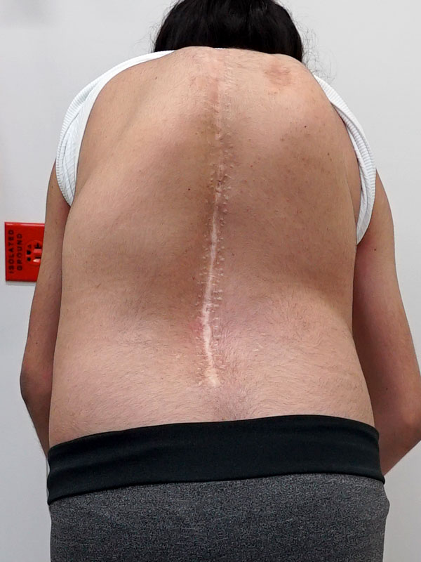 Pre-Op